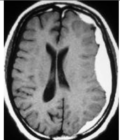 Снимки мрт головного мозга больного и здорового человека thumbnail